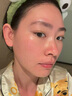 焦博士日本曬后修復(fù)面膜修復(fù)敏感皮膚屏障受損泛紅醫(yī)美用防曬傷急救白 曬單實(shí)拍圖
