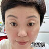 EDRI川字紋貼抬頭紋去除神器男重度額頭皺紋睡覺貼提拉緊致抗皺女專用 曬單實拍圖