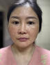 同仁堂美白祛斑霜祛斑美白淡斑黑色素去斑老年黃褐斑雀斑曬斑黑繃帶面霜 買(mǎi)2送1【針對重度色斑】 曬單實(shí)拍圖