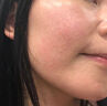 內(nèi)廷上用曬后曬傷修復(fù)膏藥皮膚屏障受損泛紅日光性皮炎紫外線過敏脫皮止癢 一盒【曬傷專用噴霧】 曬單實(shí)拍圖