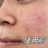 ZHENMI新加坡進(jìn)口377氨基酸洗面奶男女士控油祛痘去黑頭淡斑提亮膚色 曬單實(shí)拍圖