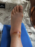 合佳下肢抬高墊骨折神器癱瘓病人翻身墊臥床老人腿枕康復腿墊孕婦腿部 曬單實(shí)拍圖