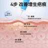 振德醫用硅酮凝膠敷料疤痕膏祛疤克星凝膠去疤膏兒童剖腹產(chǎn)美皮膚 20g 曬單實(shí)拍圖