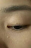 小菱制藥脂肪粒去除藥膏神器清肌眼霜眼周眼部專(zhuān)用去小顆粒脂肪瘤康汗管瘤 曬單實(shí)拍圖
