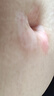 希格瑪308白癜風(fēng)治療儀西格瑪UVB銀屑病紫外線(xiàn)準分子激光光療儀醫院同款 【SQ308PCHFD】50強度-重度手腳小面積 曬單實(shí)拍圖