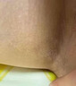 秋雅奈緒股癬專(zhuān)擁用藥膏股癬膏大腿內側真菌感染腹股溝股癬陰囊瘙癢止癢膏 一盒裝【體驗裝】 曬單實(shí)拍圖