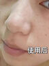 ZHENMI新加坡進(jìn)口377美白清潔泥膜深層清潔去黑頭收縮毛孔粉刺面膜祛痘 曬單實(shí)拍圖