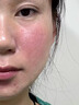 Newliann醫用重組膠原蛋白修復敷料乳液人表皮生長(cháng)因子凝膠皮膚屏障面霜 曬單實(shí)拍圖
