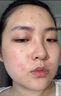 DR JEVEITAL 潔維塔博士積雪草祛痘面霜水楊酸壬二酸祛痘膏50ml 男女青春痘閉口粉刺痘坑 曬單實(shí)拍圖