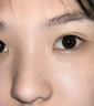 醫用精華液械字號收縮毛孔粗大修復細致去黑頭粉刺閉口男士女士祛痘印黑色素沉淀控油淡化痘印痘坑透明質(zhì)酸鈉 曬單實(shí)拍圖