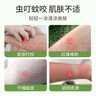 ehmznv紫草膏舒爽膏夏日清涼舒爽蚊蟲子叮咬呵護(hù)保濕肌膚腫包清涼膏潤(rùn)膚 8g 3支 植萃舒癢紫草膏 曬單實(shí)拍圖
