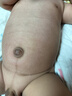 葵花臍疝貼嬰兒0-3個(gè)月小兒臍疝帶新生兒寶寶肚臍突出疝氣凸肚臍專(zhuān)用 單盒裝 曬單實(shí)拍圖