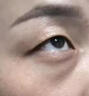 脂肪粒去除藥膏眼部專(zhuān)用神器去眼周小顆粒油脂粒眼霜消汗管瘤克星 一盒裝：專(zhuān)用精華素 曬單實(shí)拍圖