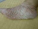腳醫(yī)生腳臭粉兒童鞋襪臭腳汗癢氣味重腳出汗腳臭專(zhuān)用山藥足光粉 曬單實(shí)拍圖