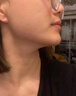 BVSYL德國高端醫(yī)用痘痘貼消炎吸膿隱形嫩膚去痘i印痤瘡痘坑痘i疤防護貼 醫(yī)用痘痘貼48貼【隱形吸膿】 曬單實拍圖