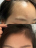 ORGINESE腺苷防脫育發(fā)液頭發(fā)增長(cháng)頭皮精華發(fā)際線(xiàn)非生發(fā)營(yíng)養劑快速生長(cháng)增發(fā) 【單盒裝 密發(fā)新生】強韌防脫育發(fā)精華液*1盒 1.5ml*40支 曬單實(shí)拍圖