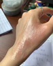 紐醫(yī)生燙傷膏熱油開水灼傷電焊紅腫起泡不留疤痕濕潤軟膏外用抑菌燒傷膏 曬單實(shí)拍圖