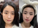 泊紫汀蘭377美白祛斑霜淡化黑色素去雀斑黃褐斑提亮改善暗沉保濕面霜乳液 曬單實拍圖