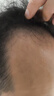 【第二代米諾地爾】蔓迪生發(fā)泡沫劑60g（倍速生發(fā) 溫和不起痘）防脫育發(fā)增發(fā)液5%濃度酊搽劑 曬單實拍圖