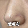 BAJK黑頭導(dǎo)出液鼻子去黑頭粉刺收縮毛孔深層清潔清理神器粗大修復(fù)閉口 【黑頭閉口粉刺】黑頭導(dǎo)出液*1瓶 黑頭粉刺丨收縮毛孔丨無效包退 曬單實(shí)拍圖