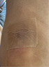 常醫(yī)護醫(yī)用硅酮疤痕貼剖腹產術后燒燙傷專用疤痕增生凸起疙瘩修復貼遮蓋 一盒【試用裝】輕度傷疤 5*100cm/1卷/盒 曬單實拍圖