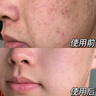 維特絲（vetes）去角質(zhì)面部啫喱控油保濕洗面奶男女士清潔毛孔黑頭閉口溫沒激素和 【6大專利】果酸去角質(zhì)啫喱200g 曬單實(shí)拍圖