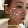 焦博士日本377祛斑霜美白淡化老年黃褐雀斑黑色素熊果苷乳膏去曬男女士 曬單實拍圖