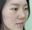 白云山377煙酰胺面霜美白祛斑霜淡化黑色素去老黃斑雀斑抗氧化保濕50g 曬單實(shí)拍圖