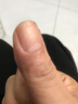 多本康奈抑菌膏正品多本康奈皮膚抑菌膏 兩盒裝 曬單實(shí)拍圖