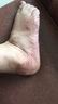 樂(lè )家老鋪南京同仁堂去腳氣腳臭舒緩止癢腳皮爛臭真菌感染皮膚抑菌 曬單實(shí)拍圖