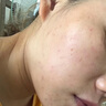 學(xué)生青春痘祛痘膏痤瘡內服藥玫瑰痤瘡粉刺痤瘡痘痘治祛痘消炎痤瘡專(zhuān)用藥青少年淡化痘印復方珍珠暗瘡片 【單盒】國藥正品OTC 【國藥準字】特新效期 曬單實(shí)拍圖