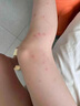 戶(hù)凈戶(hù)外防跳蚤噴霧人用家用藥無(wú)毒床上母嬰寶寶兒童驅防跳蚤特效神器 1瓶裝 一噴蟲(chóng)全跑 曬單實(shí)拍圖