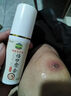 傷口快速愈合藥外傷創(chuàng)傷消炎割傷皮外傷長(zhǎng)肉快的結(jié)痂促進(jìn)生肌噴霧 促進(jìn)傷口愈合【60ml/一盒裝】 曬單實(shí)拍圖