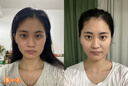 OHBT黃芪面膜10片抗皺緊致抗衰老補(bǔ)水熬夜美白淡斑女男士金榜第1名 曬單實(shí)拍圖