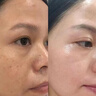 OHBT黃芪面膜10片抗皺緊致抗衰老補水熬夜亮白淡斑女男士金榜第1名 曬單實(shí)拍圖