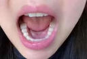 補(bǔ)牙洞材料自己補(bǔ)牙神器牙齒修復(fù)補(bǔ)牙縫蛀牙洞臨時(shí)門牙齒修復(fù)填充 1盒【補(bǔ)牙神器】能補(bǔ)10顆 曬單實(shí)拍圖