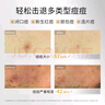 敷爾佳【成毅同款】乳糖酸控油斂膚面膜  收縮毛孔祛痘補(bǔ)水保濕油痘 4盒（20片）+1片 曬單實(shí)拍圖