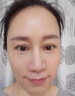 阿琪思豐盈面部太陽(yáng)穴下巴淚溝眼窩額頭填充凹陷修復神器去法令精華液 曬單實(shí)拍圖