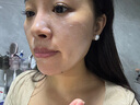 華美科 HURMEVKOR熊果苷乳膏退黑色素?zé)燉０纺z復(fù)方熊果苷軟膏熊果苷乳霜補(bǔ)水1支 曬單實拍圖