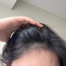 LD男女士專用進(jìn)口原料毛囊去屑止癢控油蓬松除螨炎清潔胖東來洗發(fā)水 二瓶周期裝【健康毛囊無煩惱】 曬單實(shí)拍圖