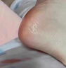 香港大藥房真菌王手足癬真菌感染皮i炎濕i疹腳氣臭皮膚瘙癢止癢抑菌專(zhuān)用膏藥 1瓶噴霧劑【德國原裝進(jìn)口】京東 香港大藥房方官正品腳趾縫癢潰爛脫皮腳出汗酸臭噴霧劑 曬單實(shí)拍圖
