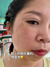 泊紫汀蘭377美白祛斑霜淡化黑色素去雀斑黃褐斑提亮改善暗沉保濕面霜乳液 曬單實拍圖