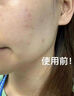 維特絲氨基酸洗面奶男女士500g控油祛痘深層清潔黑頭粉刺護(hù)膚美白潔面乳 曬單實(shí)拍圖