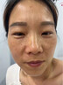 南京同仁堂美白祛斑霜50g去雀斑黃褐斑老年曬斑淡化黑色提亮膚色面霜男女士 3瓶輕度斑 【立省40】 曬單實拍圖
