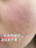 Masata新加坡進(jìn)口青少年洗面奶控油祛痘除螨去黑頭粉刺男女氨基酸150ml 曬單實(shí)拍圖