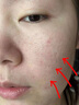 維特絲（vetes）去角質(zhì)面部啫喱控油保濕洗面奶男女士清潔毛孔黑頭閉口溫沒激素和 【6大專利】果酸去角質(zhì)啫喱200g 曬單實拍圖