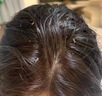 初蔓二硫化硒洗發(fā)水醫(yī)用男女士去屑止癢控油持久蓬松防脫育發(fā)水楊酸 【控油去屑】二硫化硒洗發(fā)水500ml 【青少年成人】洗發(fā)水TOP第1名 曬單實(shí)拍圖