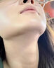 福隆藤原去疤痕修復(fù)凝膠醫(yī)院專用去疤膏兒童擦傷摔傷疤痕增生凸起去除疙瘩 一盒裝【疤痕克星】 曬單實拍圖