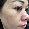 膚研祛斑霜美i白淡化老年黃褐雀斑黑色素斑臉部手背祛斑專用去老人斑 特效一盒【祛斑專用】醫(yī)用 祛斑效果最好的產品 曬單實拍圖