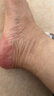森呈足型腳氣脫皮止癢腳趾縫爛癢腳出汗腳臭爛腳丫足癬糜爛森呈足部型 【中度者使用】噴劑*2+乳膏*2 曬單實拍圖